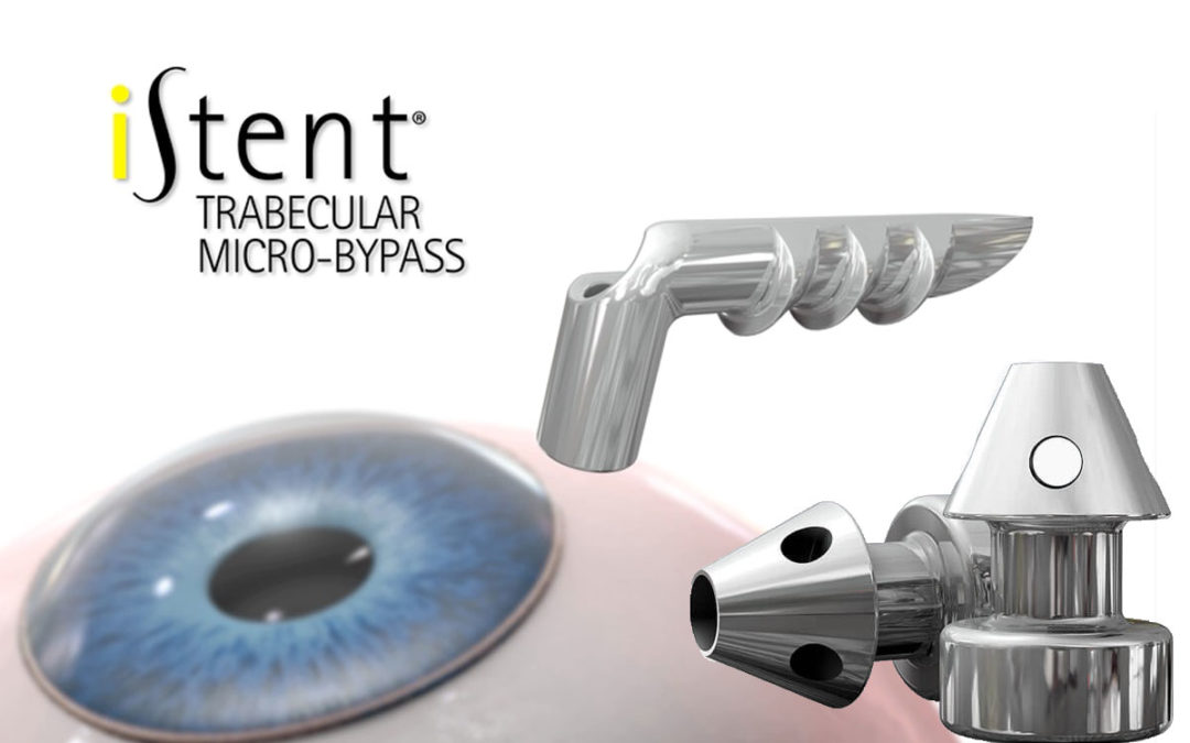 Istent-new implant- glaucoma surgery