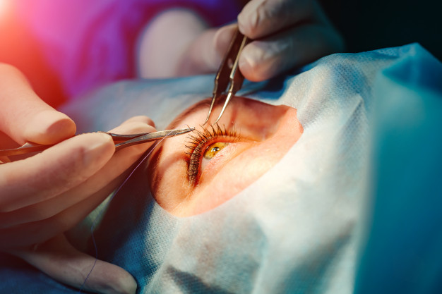 KERATOCONUS. WHAT IS IT?, HOW IS IT TREATED?